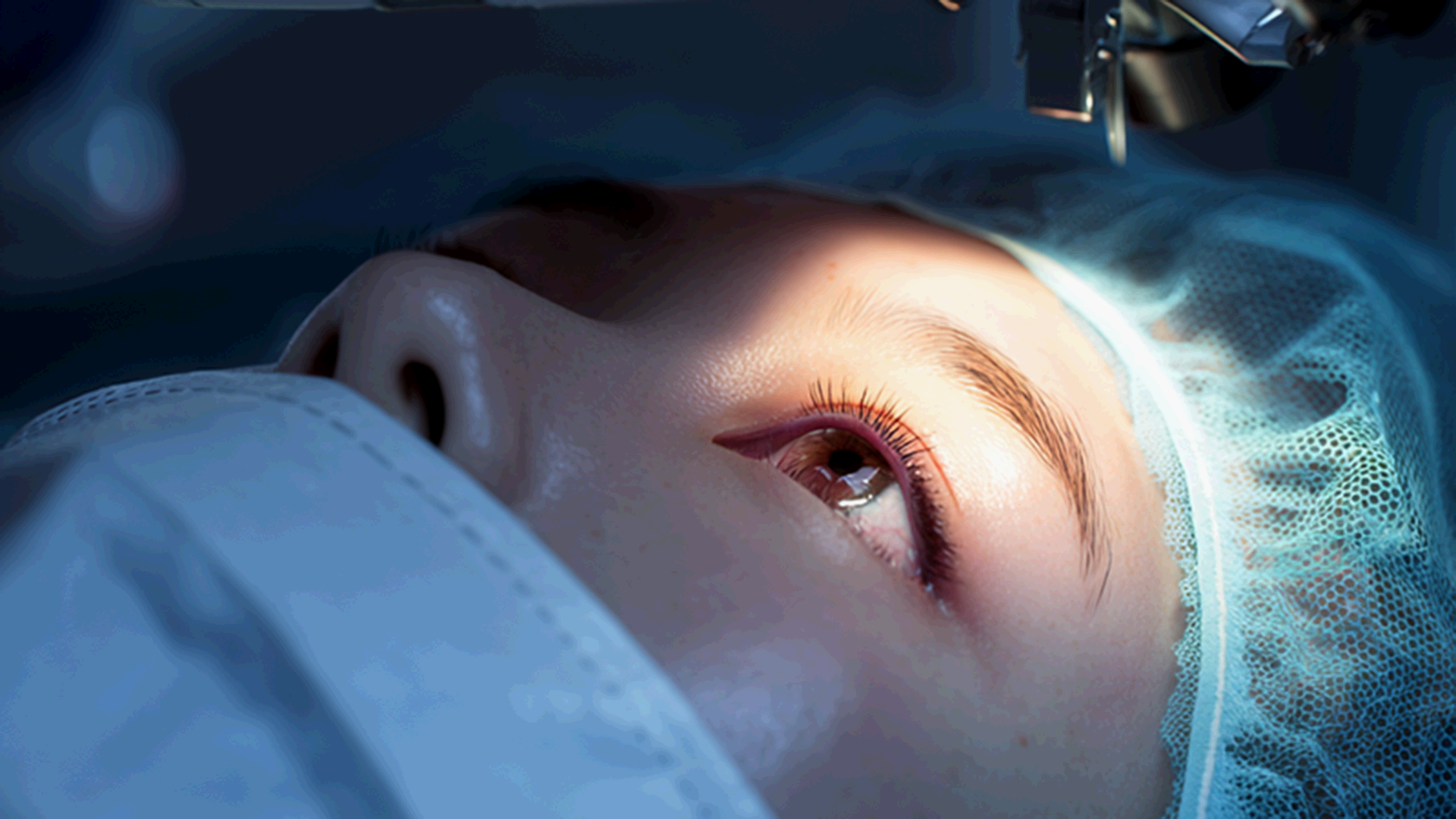 SMILE PRO vs SMILE LASIK: What’s the Difference?